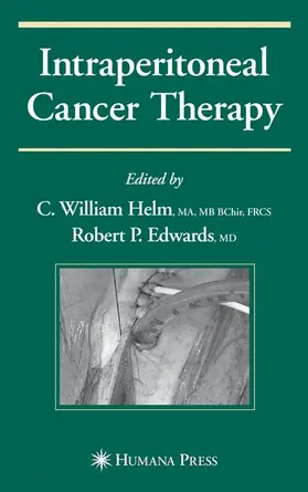 Edwards / Helm |  Intraperitoneal Cancer Therapy | Buch |  Sack Fachmedien