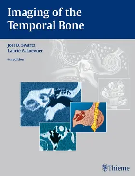 Swartz / Loevner | Imaging of the Temporal Bone | Buch | 978-1-58890-345-7 | sack.de