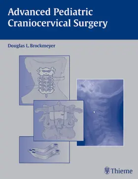 Brockmeyer |  Advanced Pediatric Craniocervical Surgery | Buch |  Sack Fachmedien