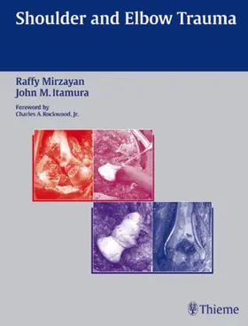 Mirzayan / Itamura |  Shoulder and Elbow Trauma | eBook | Sack Fachmedien