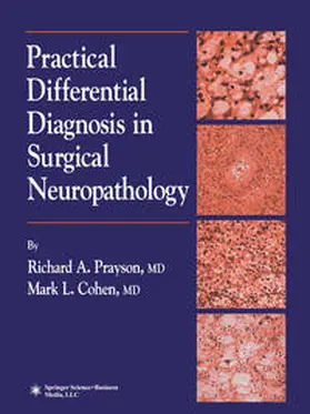 Prayson / Cohen |  Practical Differential Diagnosis in Surgical Neuropathology | eBook | Sack Fachmedien