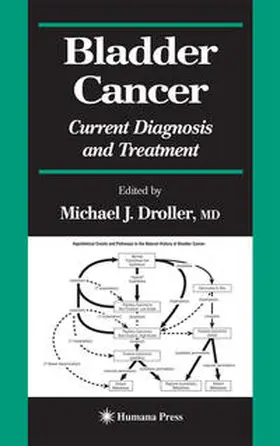 Droller |  Bladder Cancer | eBook | Sack Fachmedien