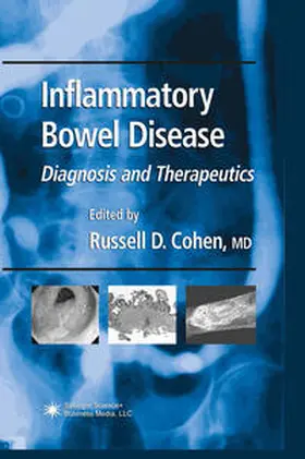 Cohen |  Inflammatory Bowel Disease | eBook | Sack Fachmedien