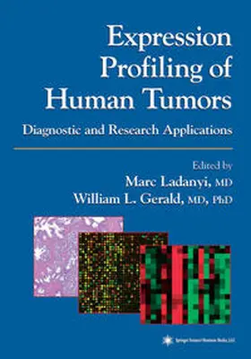 Ladanyi / Gerald | Expression Profiling of Human Tumors | E-Book | www2.sack.de