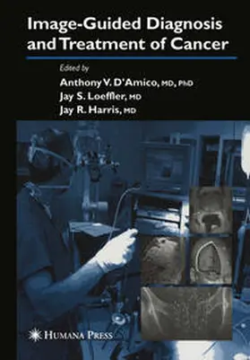D’Amico / Harris |  Image-Guided Diagnosis and Treatment of Cancer | eBook | Sack Fachmedien