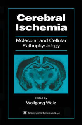 Walz |  Cerebral Ischemia | eBook | Sack Fachmedien