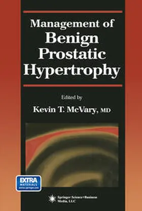 McVary |  Management of Benign Prostatic Hypertrophy | eBook | Sack Fachmedien