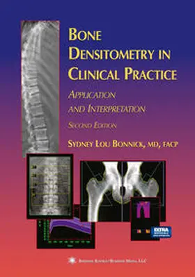 Bonnick |  Bone Densitometry in Clinical Practice | eBook | Sack Fachmedien