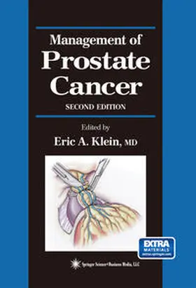 Klein |  Management of Prostate Cancer | eBook | Sack Fachmedien