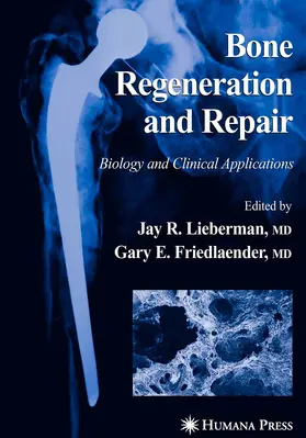 Lieberman / Friedlaender | Bone Regeneration and Repair | E-Book | www2.sack.de