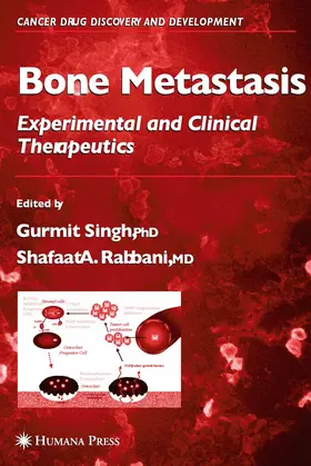 Singh / Rabbani | Bone Metastasis | E-Book | sack.de
