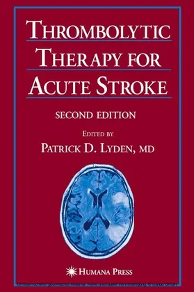 Lyden |  Thrombolytic Therapy for Acute Stroke | eBook | Sack Fachmedien