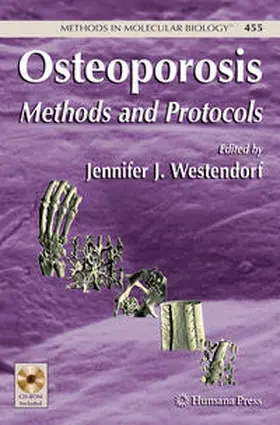 Westendorf | Osteoporosis | E-Book | www2.sack.de