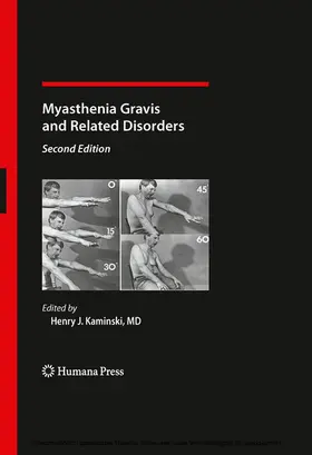 Kaminski | Myasthenia Gravis and Related Disorders | E-Book | sack.de