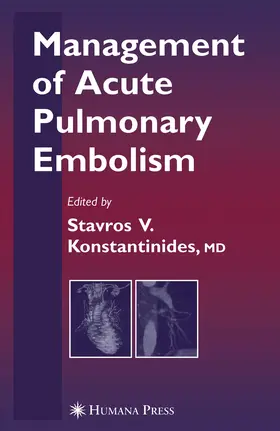 Konstantinides | Management of Acute Pulmonary Embolism | E-Book | sack.de