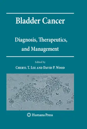 Lee / Wood |  Bladder Cancer | eBook | Sack Fachmedien