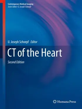 Schoepf |  CT of the Heart | Buch |  Sack Fachmedien