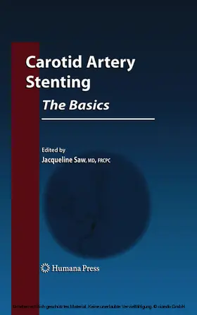 Saw | Carotid Artery Stenting: The Basics | E-Book | sack.de