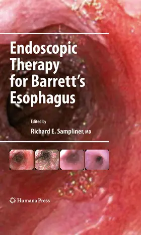 Sampliner |  Endoscopic Therapy for Barrett's Esophagus | eBook | Sack Fachmedien