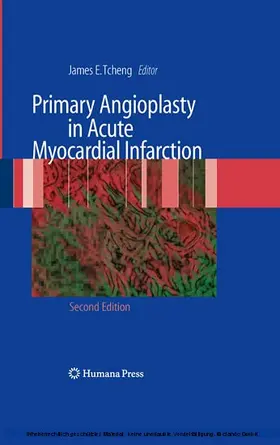 Tcheng |  Primary Angioplasty in Acute Myocardial Infarction | eBook | Sack Fachmedien