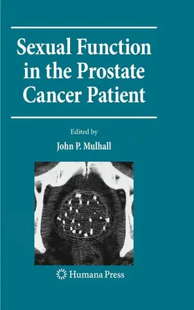 Mulhall | Sexual Function in the Prostate Cancer Patient | Buch | 978-1-60327-554-5 | www2.sack.de