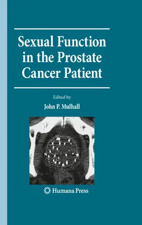 Mulhall |  Sexual Function in the Prostate Cancer Patient | eBook | Sack Fachmedien
