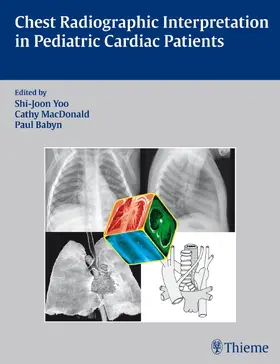 Yoo / MacDonald / Babyn |  Chest Radiographic Interpretation in Pediatric Cardiac Patients | Buch |  Sack Fachmedien