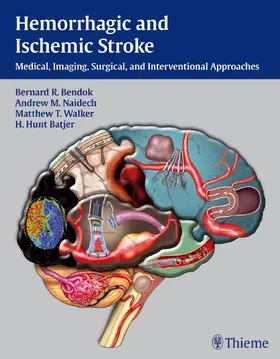 Bendok / Naidech / Walker |  Hemorrhagic and Ischemic Stroke | eBook | Sack Fachmedien