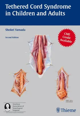 Yamada |  Tethered Cord Syndrome in Children and Adults | Buch |  Sack Fachmedien