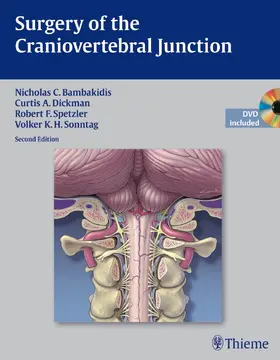 Bambakidis / Dickman / Spetzler |  Surgery of the Craniovertebral Junction | eBook | Sack Fachmedien