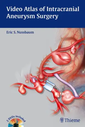 Nussbaum | Video Atlas of Intracranial Aneurysm Surgery | E-Book | sack.de