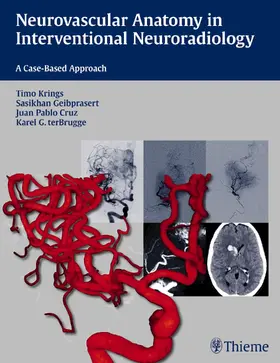 Krings / Geibprasert / Cruz |  Neurovascular Anatomy in Interventional Neuroradiology | Buch |  Sack Fachmedien