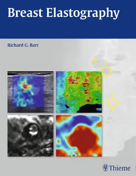 Barr |  Breast Elastography | Buch |  Sack Fachmedien