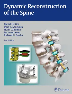Kim / Sengupta / Cammisa |  Dynamic Reconstruction of the Spine | eBook | Sack Fachmedien