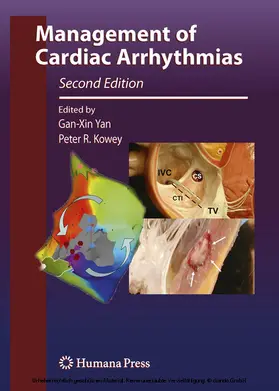 Yan / Kowey |  Management of Cardiac Arrhythmias | eBook | Sack Fachmedien