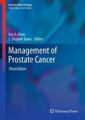 Klein / Jones |  Management of Prostate Cancer | eBook | Sack Fachmedien