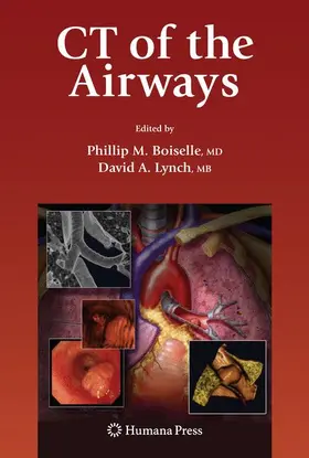 Boiselle / Lynch |  CT of the Airways | Buch |  Sack Fachmedien