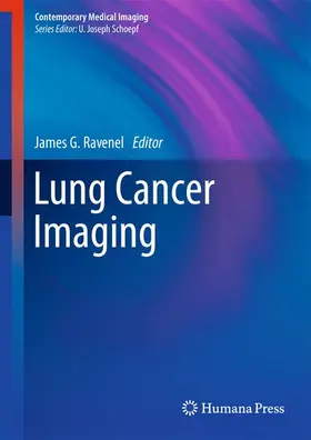 Ravenel |  Lung Cancer Imaging | Buch |  Sack Fachmedien