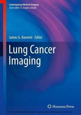 Ravenel |  Lung Cancer Imaging | eBook | Sack Fachmedien