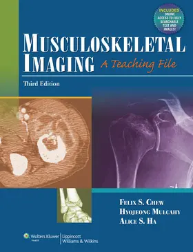 Chew |  Musculoskeletal Imaging | Buch |  Sack Fachmedien
