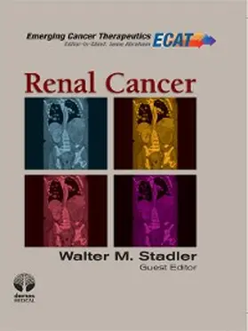  Renal Cancer | eBook | Sack Fachmedien