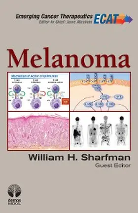  Melanoma | eBook | Sack Fachmedien