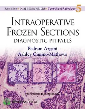 Argani / Cimino-Mathews |  Intraoperative Frozen Sections | eBook | Sack Fachmedien