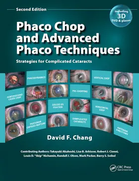 Chang |  Phaco Chop and Advanced Phaco Techniques | Buch |  Sack Fachmedien
