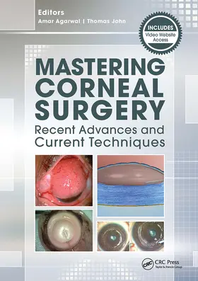 Agarwal / John |  Mastering Corneal Surgery | Buch |  Sack Fachmedien