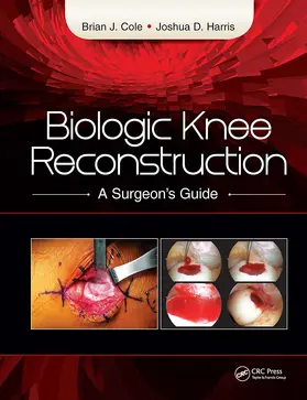 Cole / Harris | Biologic Knee Reconstruction | Buch | 978-1-61711-816-6 | sack.de