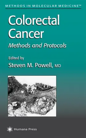 Powell |  Colorectal Cancer | Buch |  Sack Fachmedien