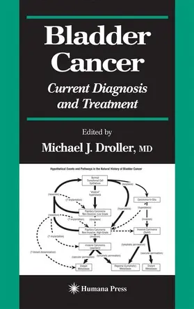 Droller |  Bladder Cancer | Buch |  Sack Fachmedien