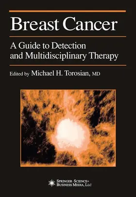 Torosian |  Breast Cancer | Buch |  Sack Fachmedien