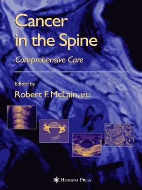 McLain / Markman / Benzel |  Cancer in the Spine | Buch |  Sack Fachmedien